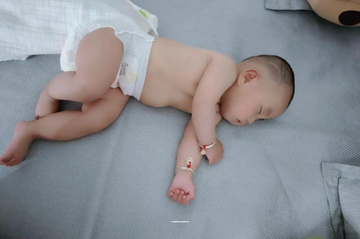 南充宝宝头上长痱子 南充宝宝头上长痱子